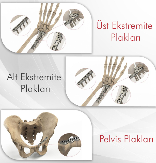 Alt Üst Ekstremite